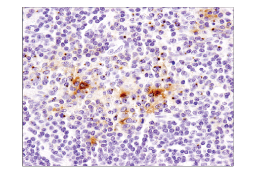Immunohistochemistry Image 1: CD40 Ligand (D5J9Y) Rabbit mAb (BSA and Azide Free)