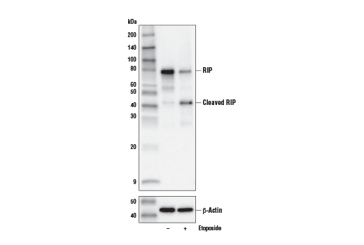  Image 26: Apoptosis/Necroptosis Antibody Sampler Kit II