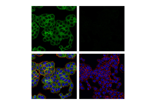 Immunofluorescence Image 1: RIP (E8S7U) XP® Rabbit mAb