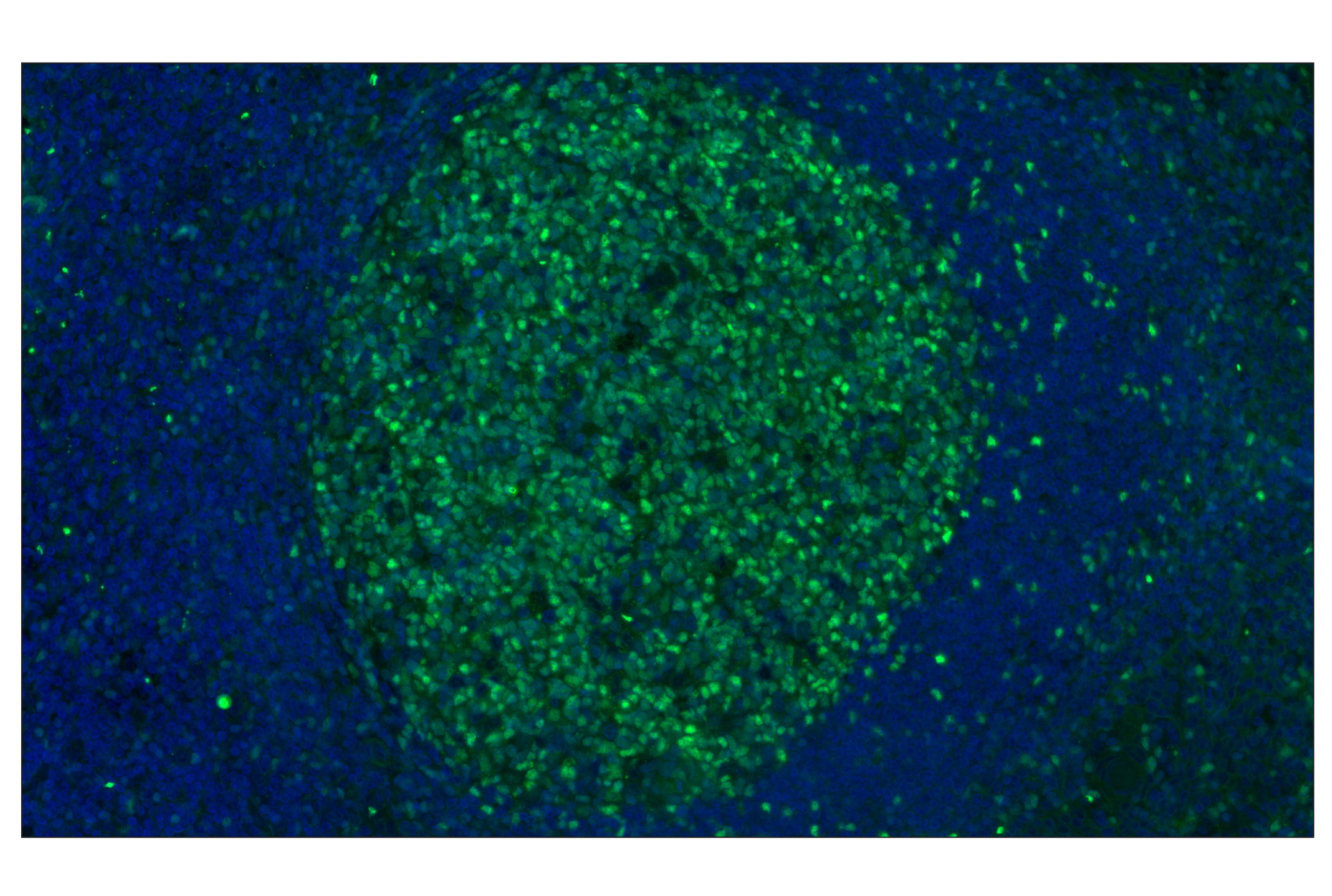 Immunohistochemistry Image 1: Tox/Tox2 (E6I3Q) Rabbit mAb (Alexa Fluor® 488 Conjugate)