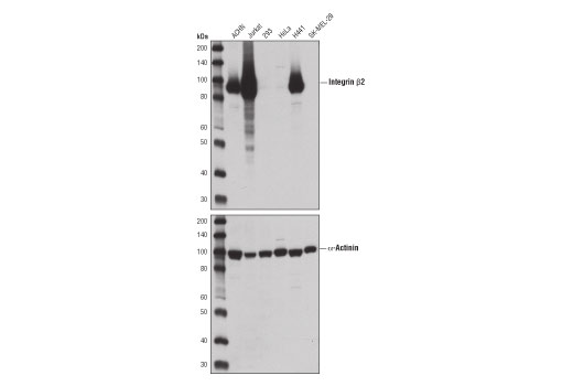  Image 7: YAP/TAZ Transcriptional Targets Antibody Sampler Kit