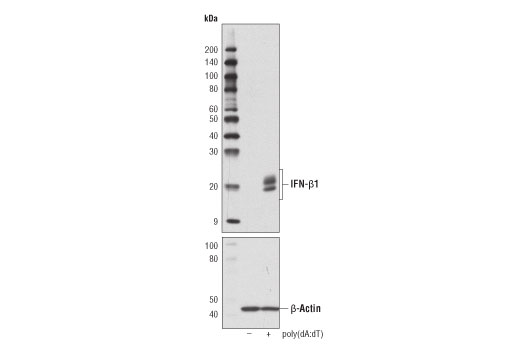  Image 14: Type I Interferon Induction and Signaling Antibody Sampler Kit