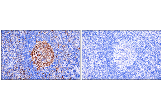  Image 87: Human Exhausted CD8+ T Cell IHC Antibody Sampler Kit