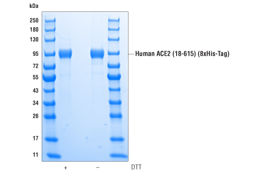  Image 2: Human ACE2 (18-615) Recombinant Protein (8xHis-Tag)