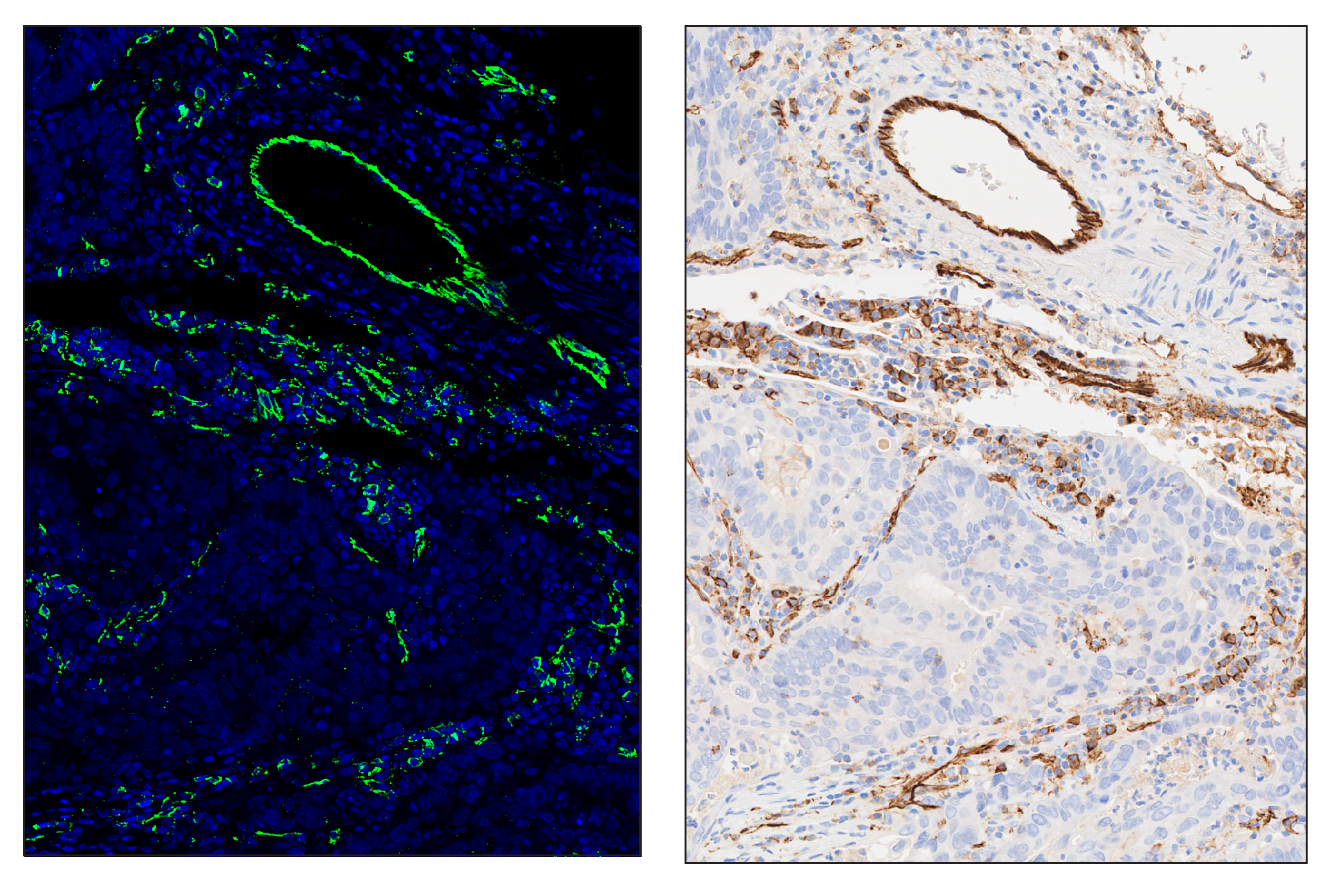 Immunohistochemistry Image 6: CD31 (PECAM-1) (89C2) & CO-0028-647 SignalStar™ Oligo-Antibody Pair