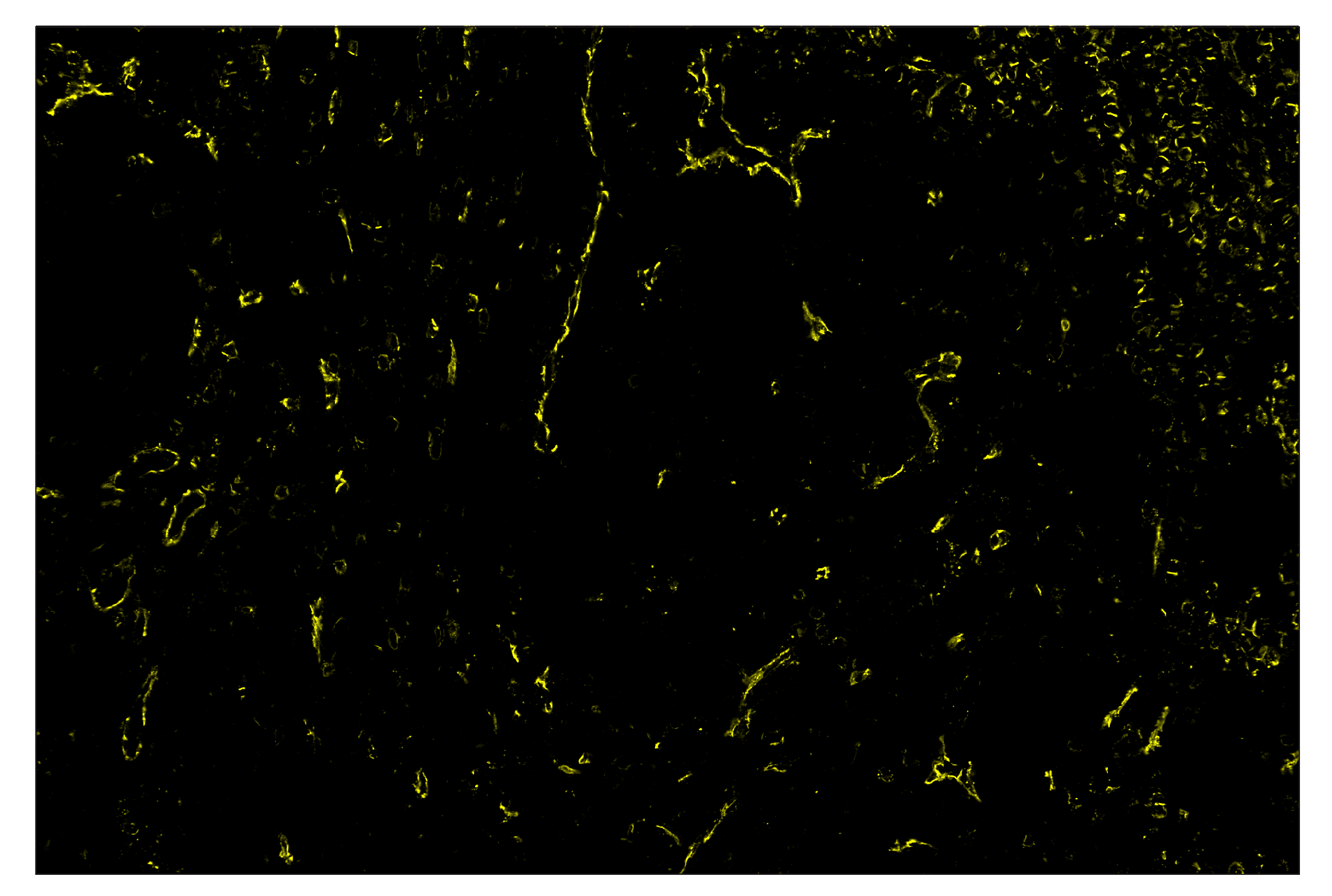 Immunohistochemistry Image 3: CD31 (PECAM-1) (89C2) & CO-0028-647 SignalStar™ Oligo-Antibody Pair