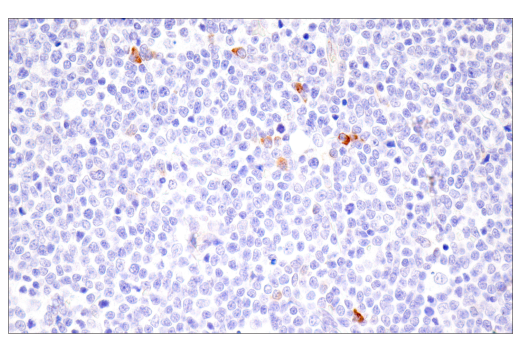 Immunohistochemistry Image 5: CTHRC1 (E8M9S) Rabbit mAb
