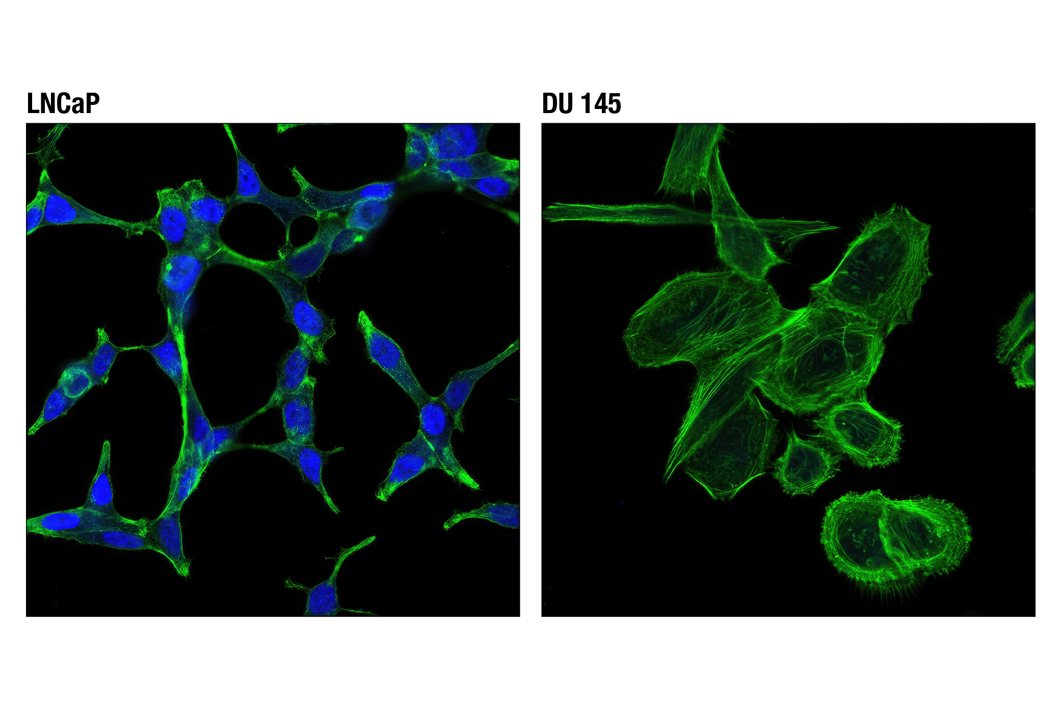 Immunofluorescence Image 1: Androgen Receptor (D6F11) XP® Rabbit mAb (Alexa Fluor® 647 Conjugate)