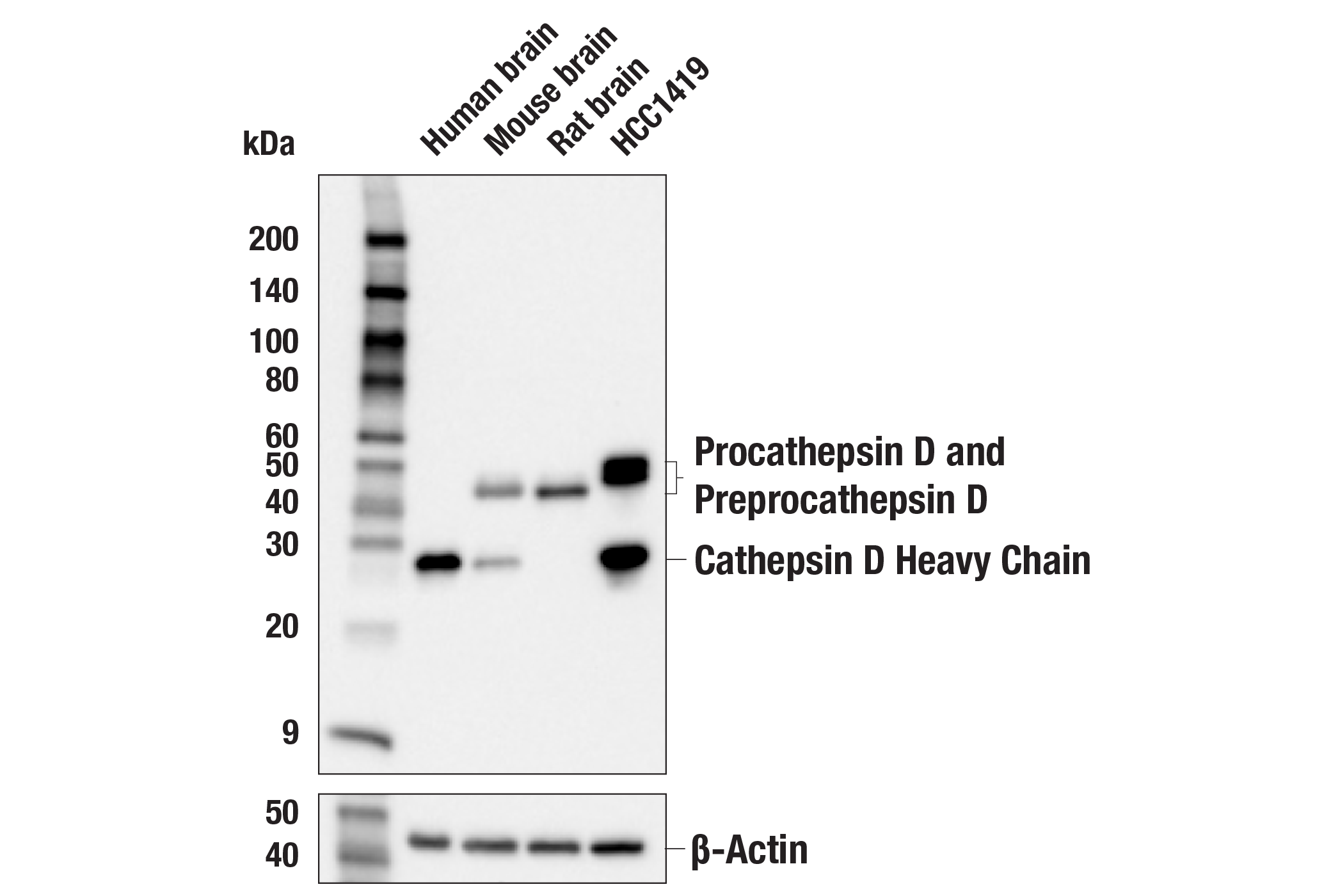 Western Blotting Image 1: Cathepsin D (E5V4H) Rabbit mAb