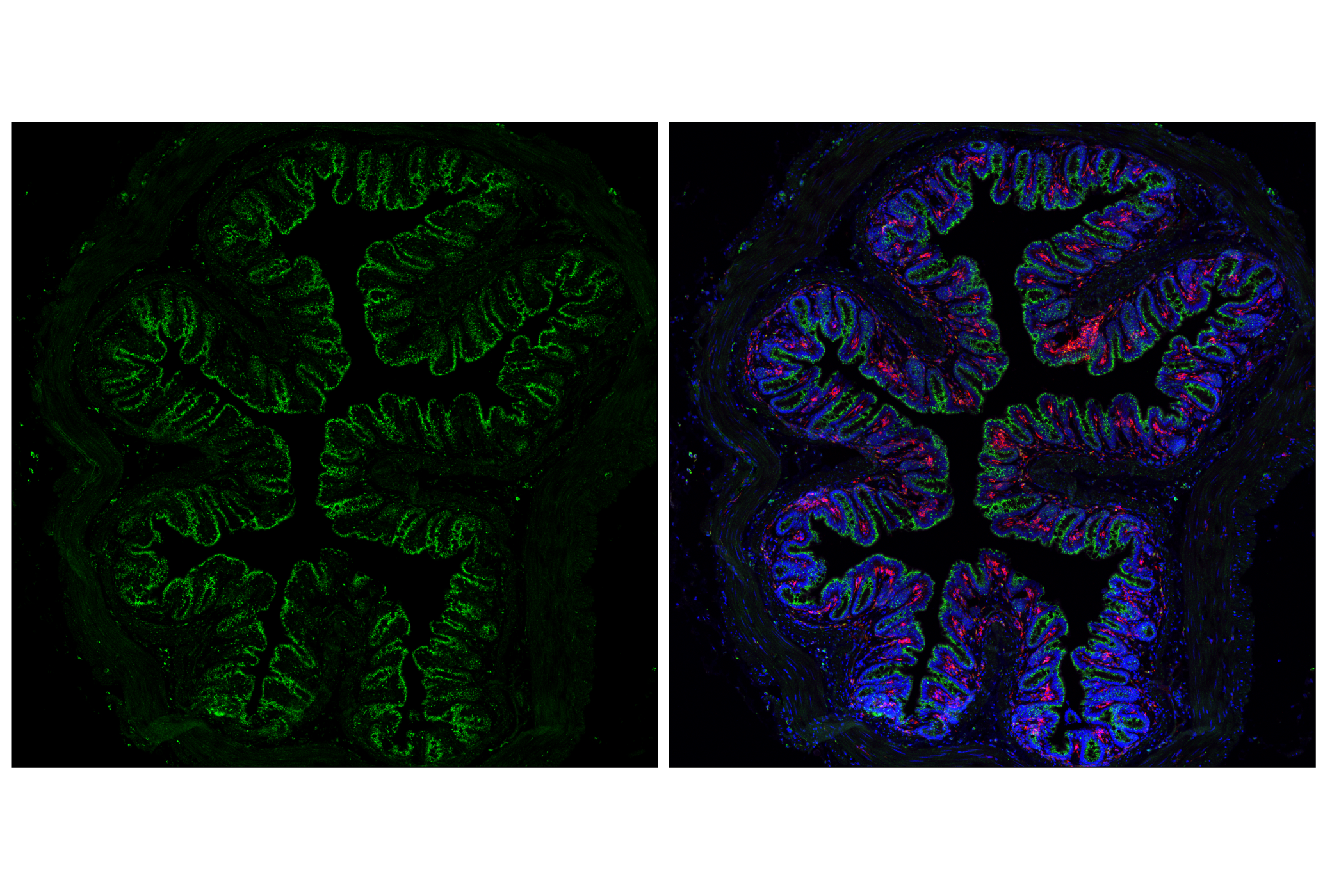 Immunofluorescence Image 4: Cathepsin D (E5V4H) Rabbit mAb