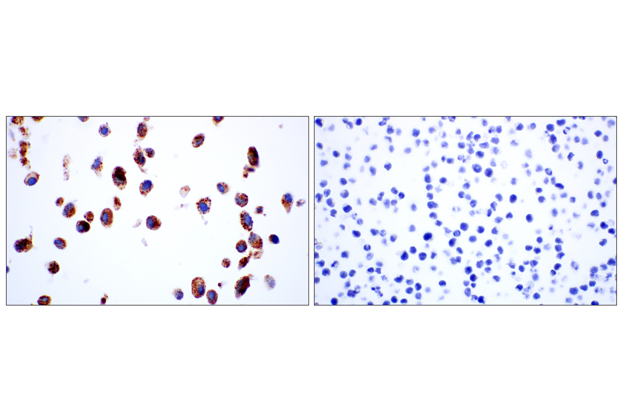 Immunohistochemistry Image 14: Cathepsin D (E5V4H) Rabbit mAb