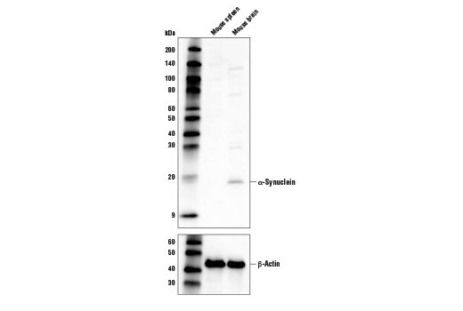 Western Blotting Image 1: α-Synuclein (D37A6) Rabbit mAb (Biotinylated)
