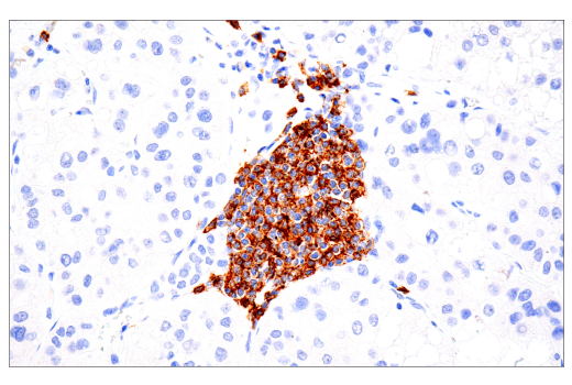 Immunohistochemistry Image 3: CD20 (L26) Mouse mAb