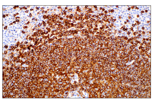 Immunohistochemistry Image 5: CD20 (L26) Mouse mAb