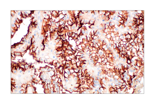 Immunohistochemistry Image 1: ACE2 (OTI1G4) Mouse mAb