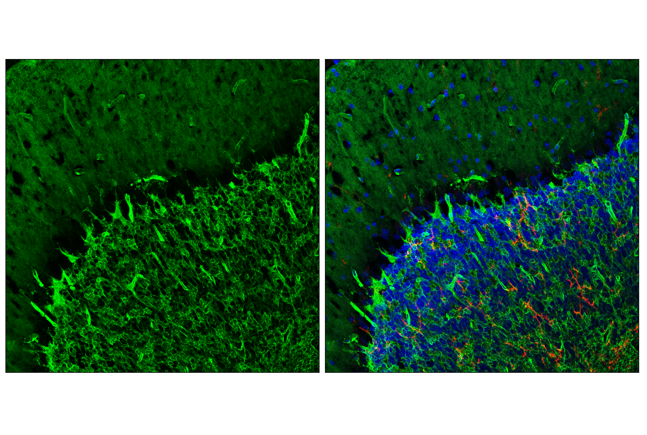 Immunofluorescence Image 1: AQP4 (E4B6T) Mouse mAb