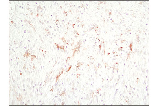Immunohistochemistry Image 2: Cleaved Caspase-3 (Asp175) (D3E9) Rabbit mAb (BSA and Azide Free)