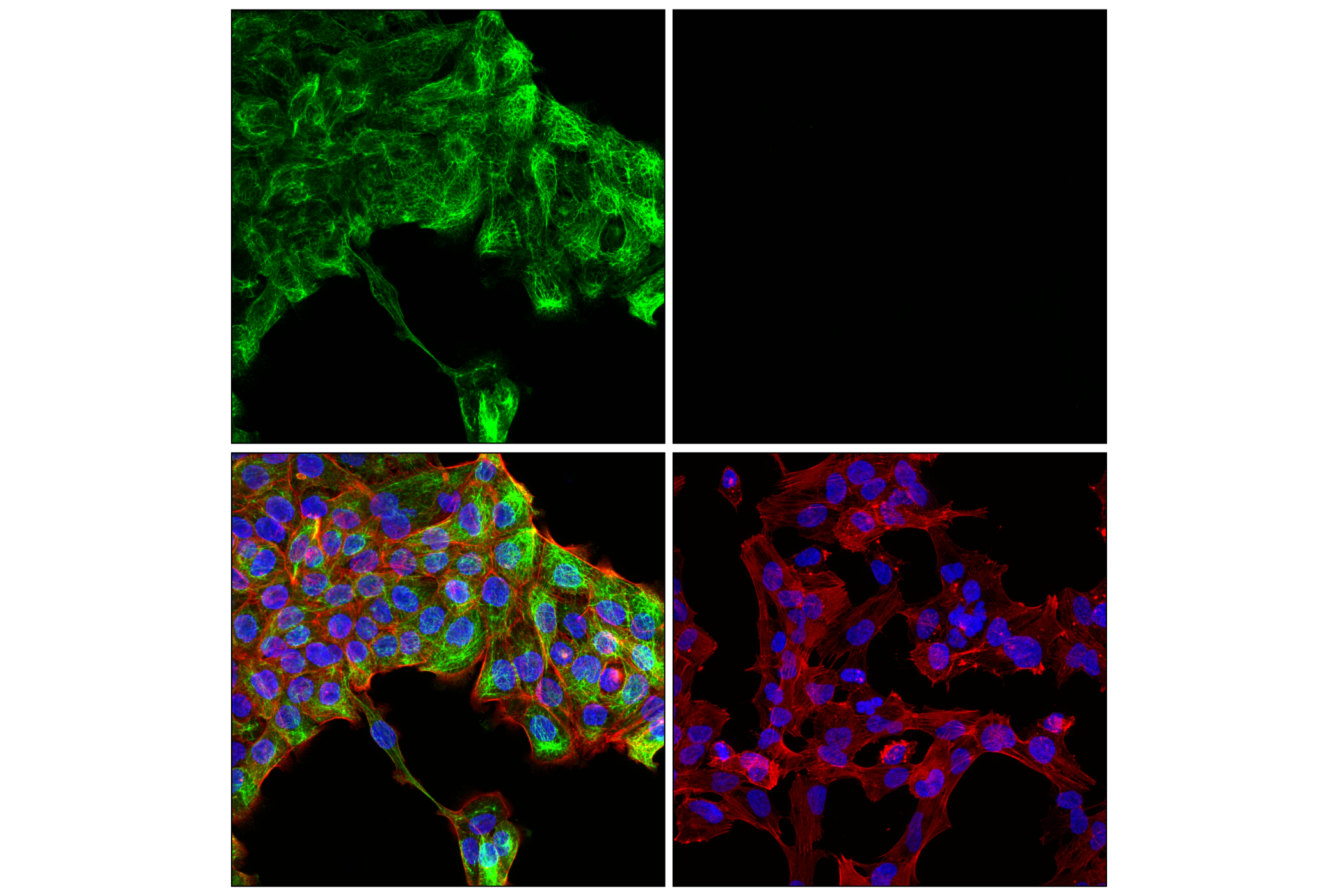 Fbxw7 (Q4) Rabbit mAb main image 1