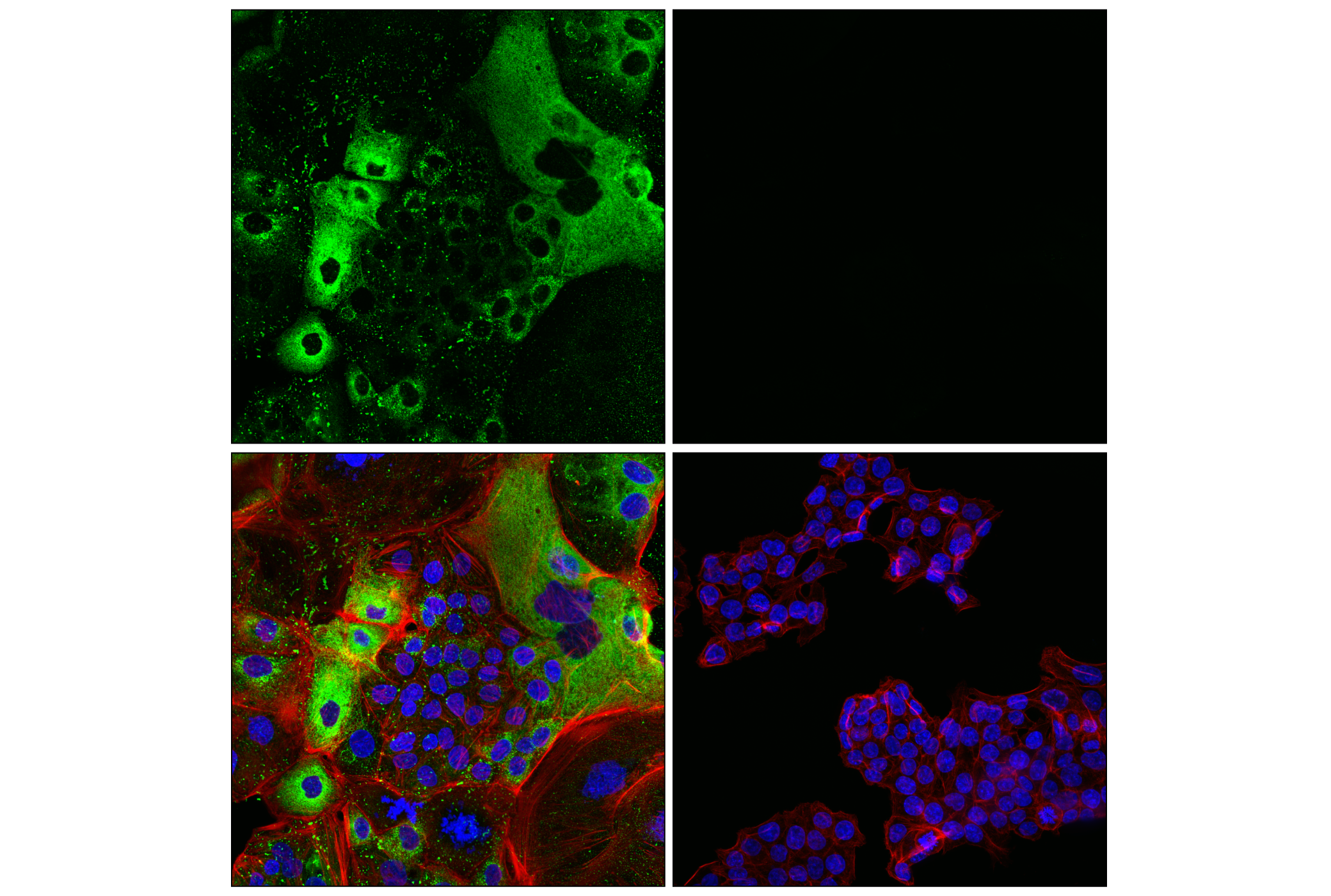 Immunofluorescence Image 1: COL4A1 (E5M6R) Rabbit mAb