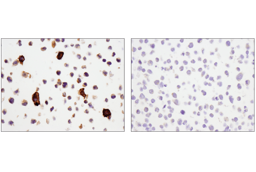 Immunohistochemistry Image 5: CD14 (D7A2T) Rabbit mAb (IHC Formulated)