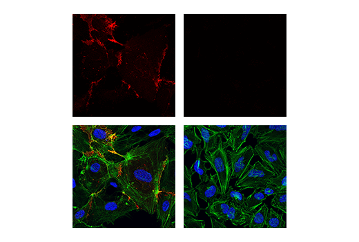 Immunofluorescence Image 1: CD31 (PECAM-1) (89C2) Mouse mAb (Alexa Fluor® 594 Conjugate)