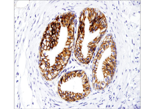 Immunohistochemistry Image 4: γ-Catenin (D9M1Q) Rabbit mAb