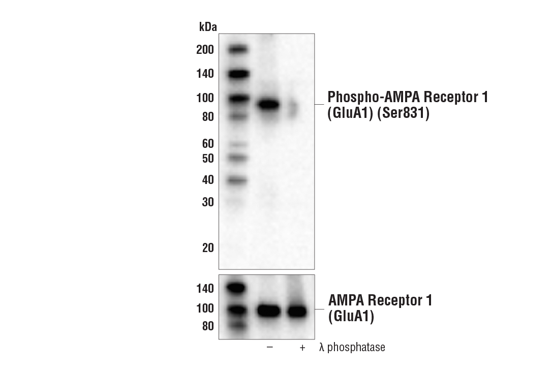  Image 21: ApoE Synaptic Formation and Signaling Pathway Antibody Sampler Kit