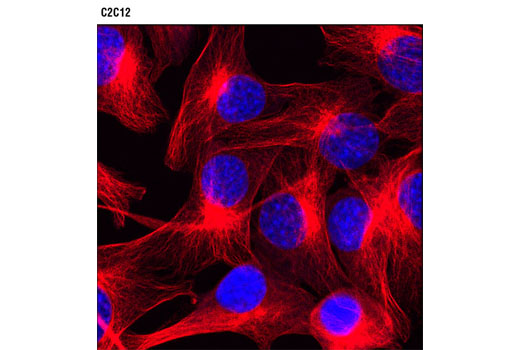 β-Tubulin (9F3) Rabbit MAb (Alexa Fluor® 594 Conjugate) | Cell ...