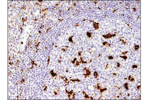  Image 6: Human Reactive M1 vs M2 Macrophage IHC Antibody Sampler Kit