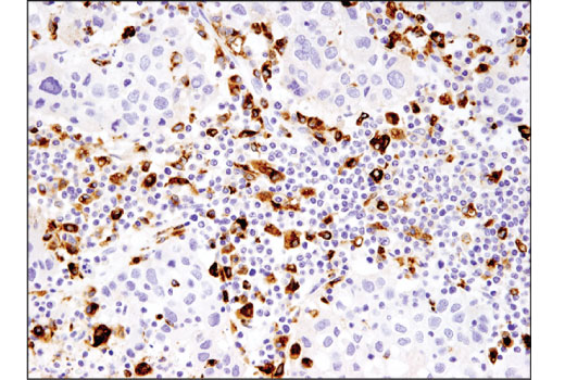 Immunohistochemistry Image 4: CD68 (D4B9C) XP® Rabbit mAb