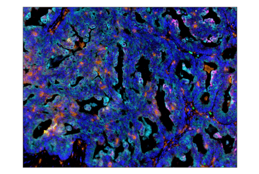  Image 40: Human Reactive M1 vs M2 Macrophage IHC Antibody Sampler Kit