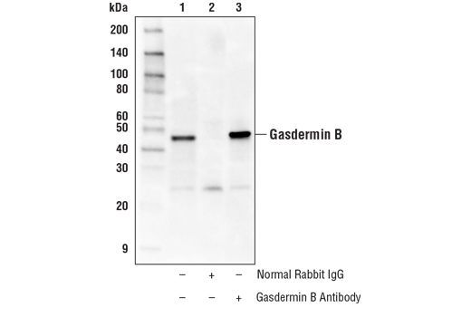  Image 21: Gasdermin Family Antibody Sampler Kit