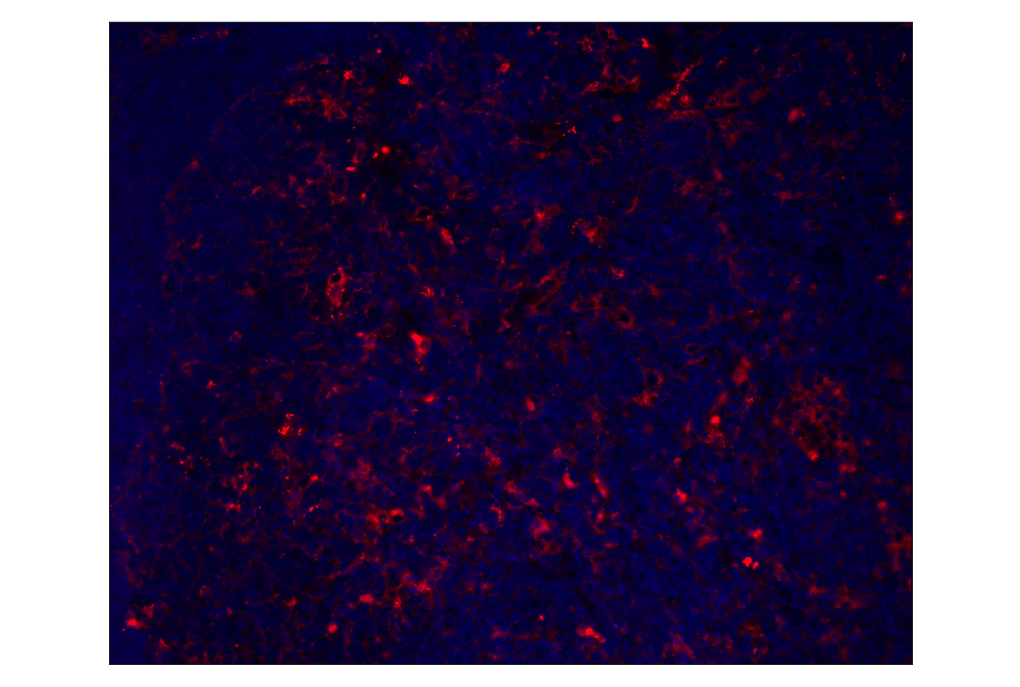 Immunohistochemistry Image 1: PD-L1 (D5V3B) Rabbit mAb (Alexa Fluor® 555 Conjugate)