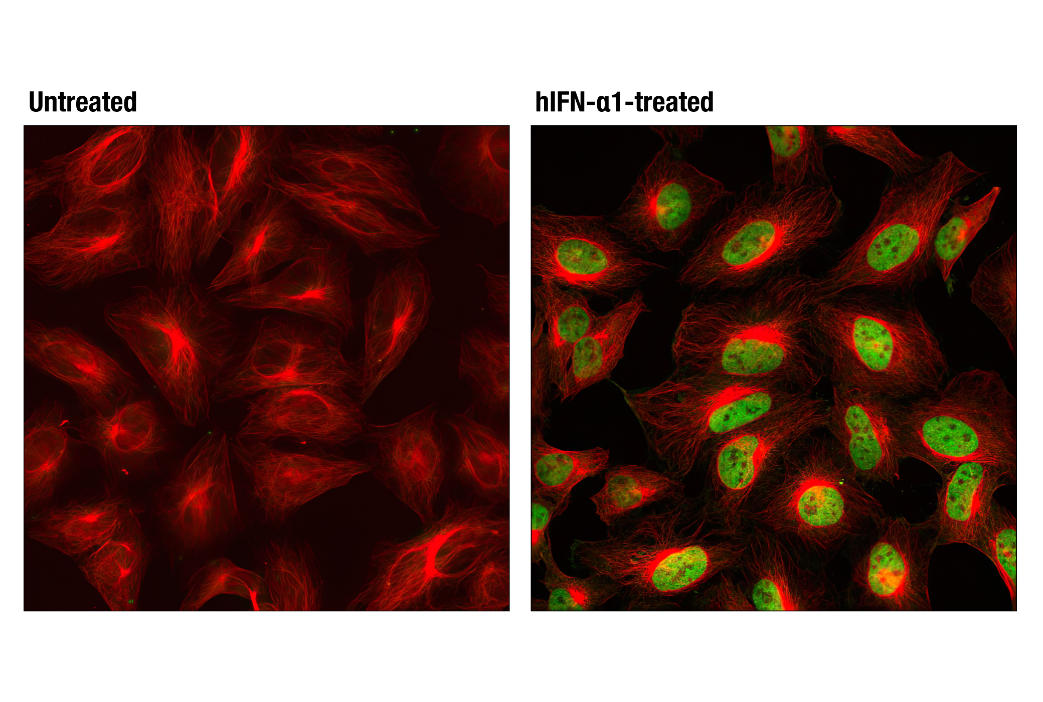 Immunofluorescence Image 1: Phospho-Stat1 (Tyr701) (D4A7) Rabbit mAb
