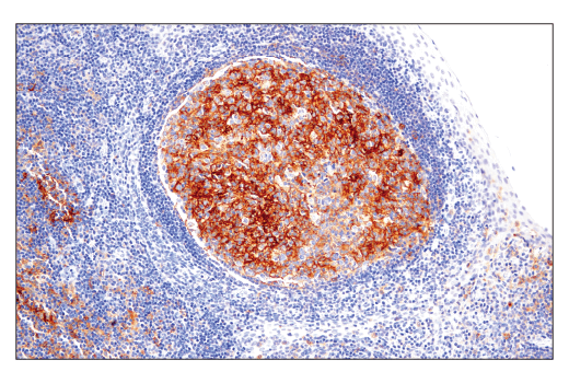 Immunohistochemistry Image 3: CD86 (E2G8P) Rabbit mAb (BSA and Azide Free)