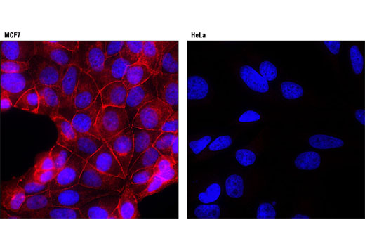 Immunofluorescence Image 1: E-Cadherin (24E10) Rabbit mAb (Alexa Fluor® 594 Conjugate)