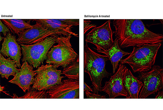 Immunofluorescence Image 1: SQSTM1/p62 (D10E10) Rabbit mAb