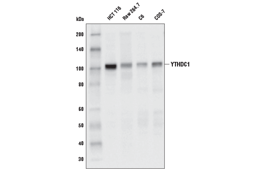  Image 16: N6-Methyladenosine (m6A) Binding Protein Antibody Sampler Kit