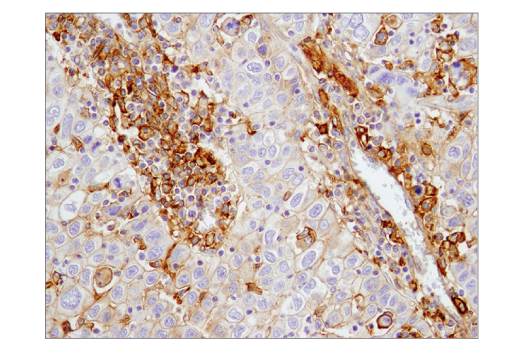 Immunohistochemistry Image 2: CD40 (D8W3N) Rabbit mAb (BSA and Azide Free)