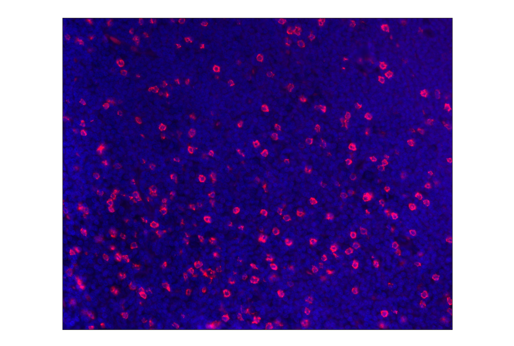 Immunohistochemistry Image 1: CD8α (D8A8Y) Rabbit mAb (Alexa Fluor® 555 Conjugate)