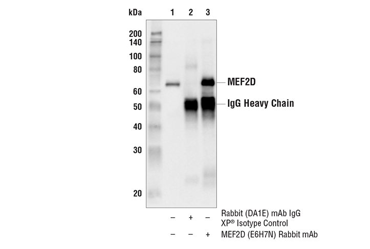 Immunoprecipitation Image 1: MEF2D (E6H7N) Rabbit mAb