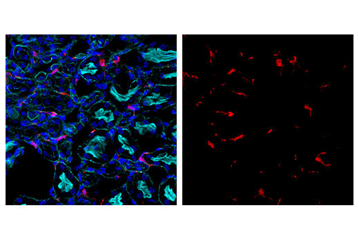Immunofluorescence Image 2: Iba1/AIF-1 (E4O4W) XP®Rabbit mAb (Alexa Fluor® 647 Conjugate)