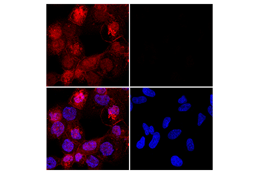Immunofluorescence Image 3: Iba1/AIF-1 (E4O4W) XP®Rabbit mAb (Alexa Fluor® 647 Conjugate)