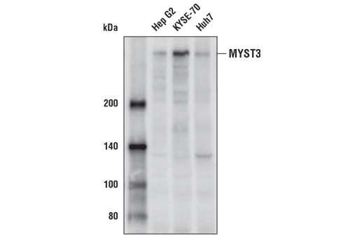Western Blotting Image 1: MYST3 Antibody