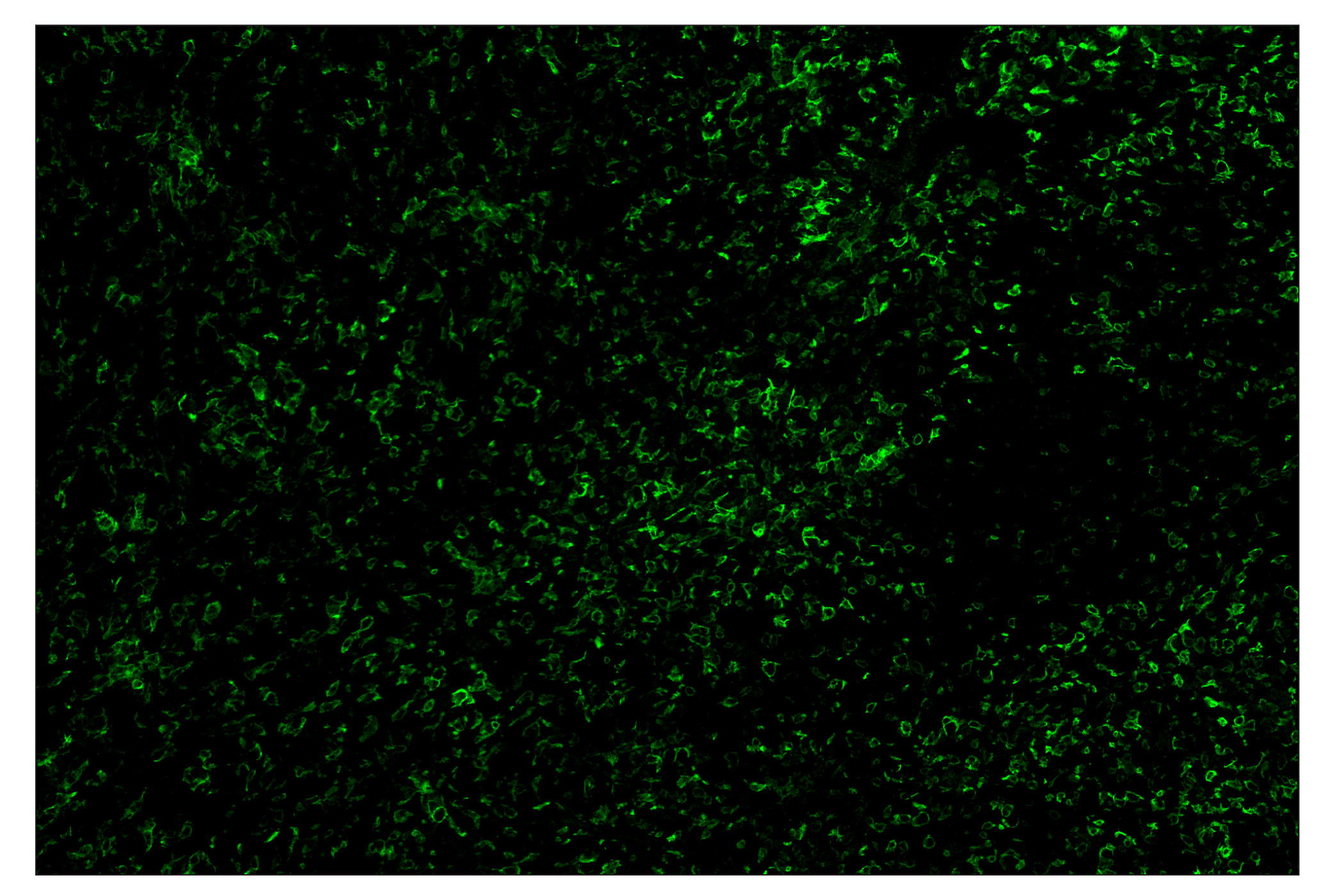 Immunohistochemistry Image 2: F4/80 (D2S9R) & CO-0042-488 SignalStar™ Oligo-Antibody Pair