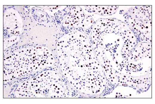 Immunohistochemistry Image 7: ATAD2 (E8Y2K) Rabbit mAb