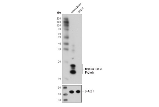 Western Blotting Image 1: Myelin Basic Protein (D8X4Q) XP® Rabbit mAb