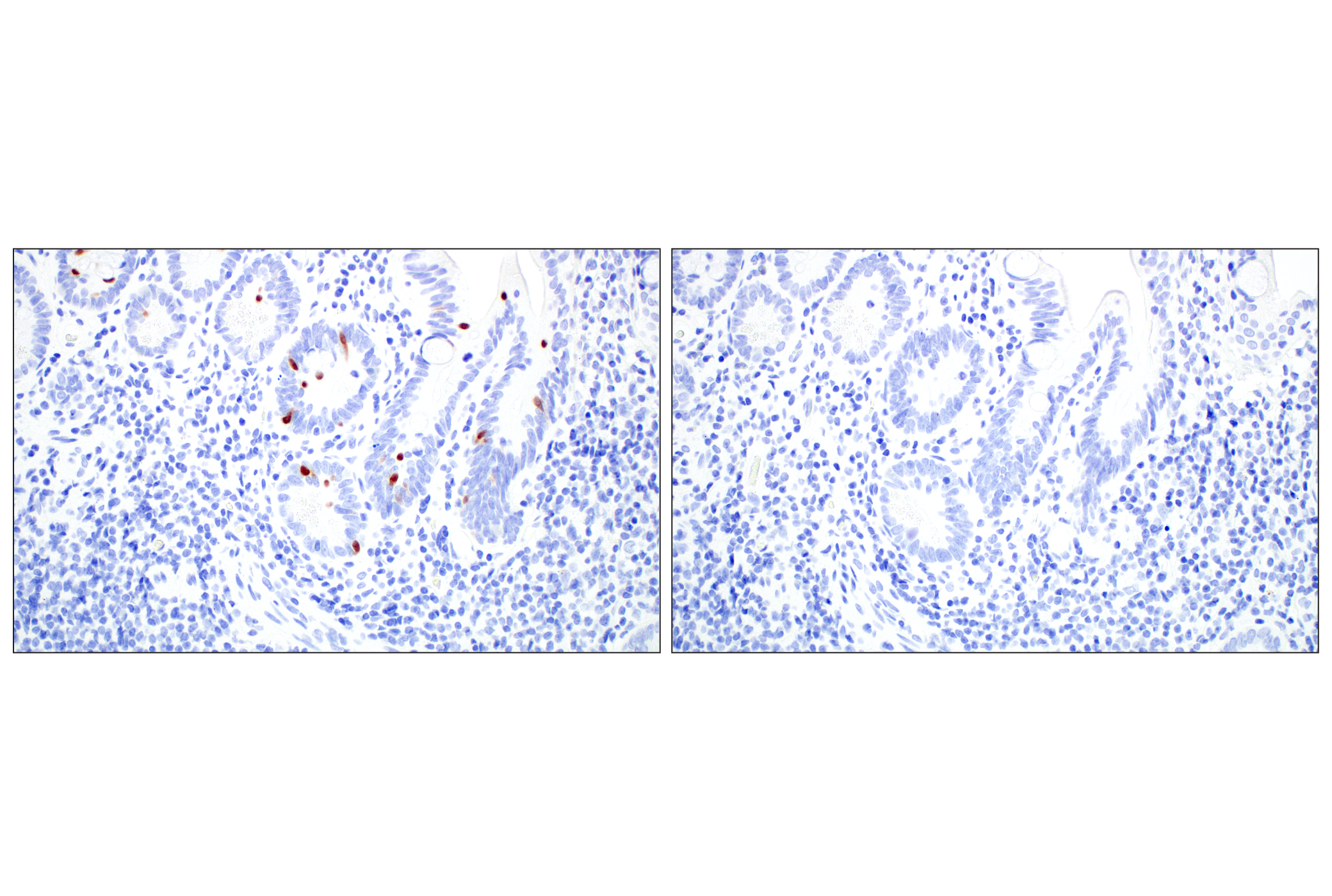 Immunohistochemistry Image 5: OCA-T1 (E4T1K) Rabbit mAb (BSA and Azide Free)