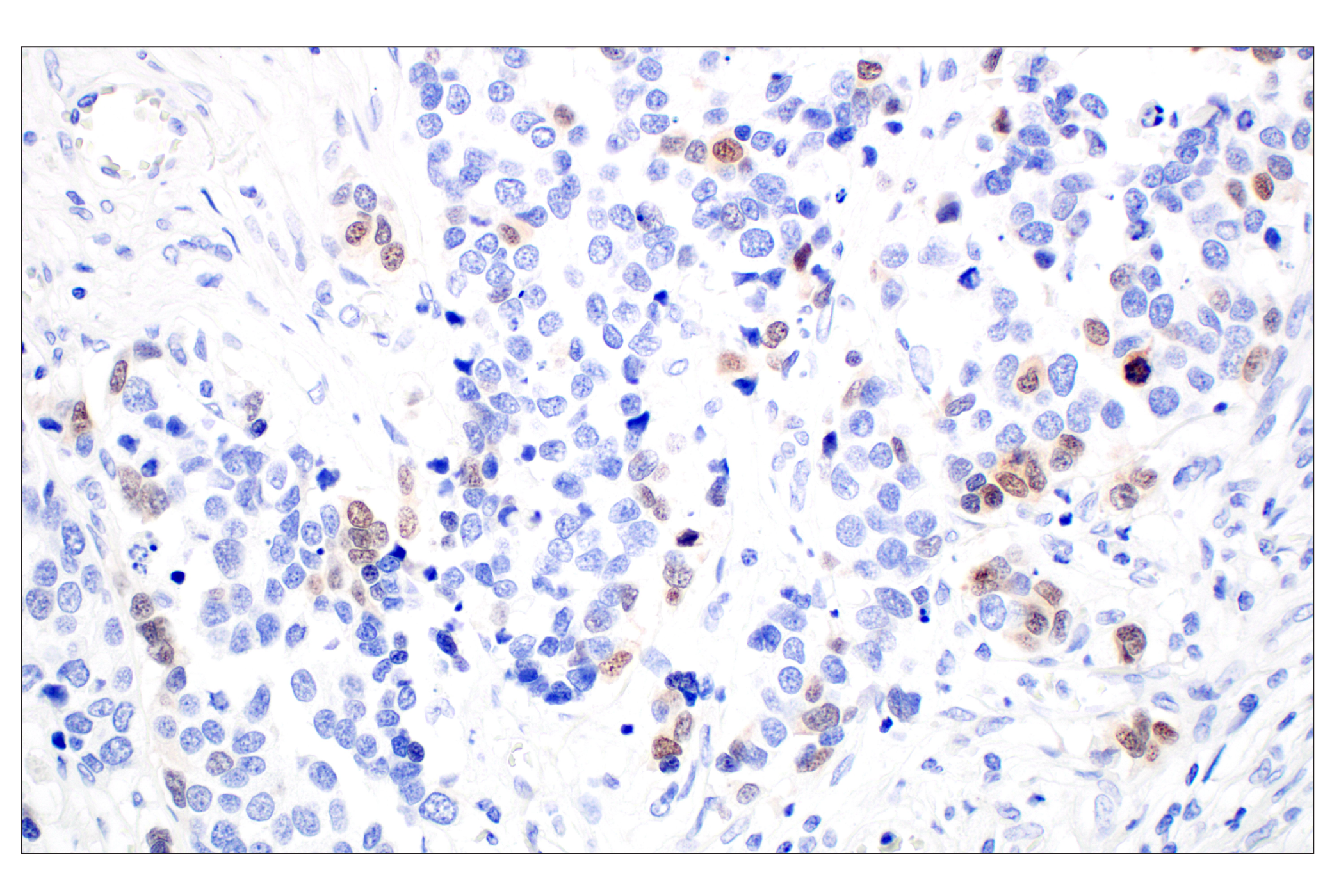 Immunohistochemistry Image 1: OCA-T1 (E4T1K) Rabbit mAb (BSA and Azide Free)