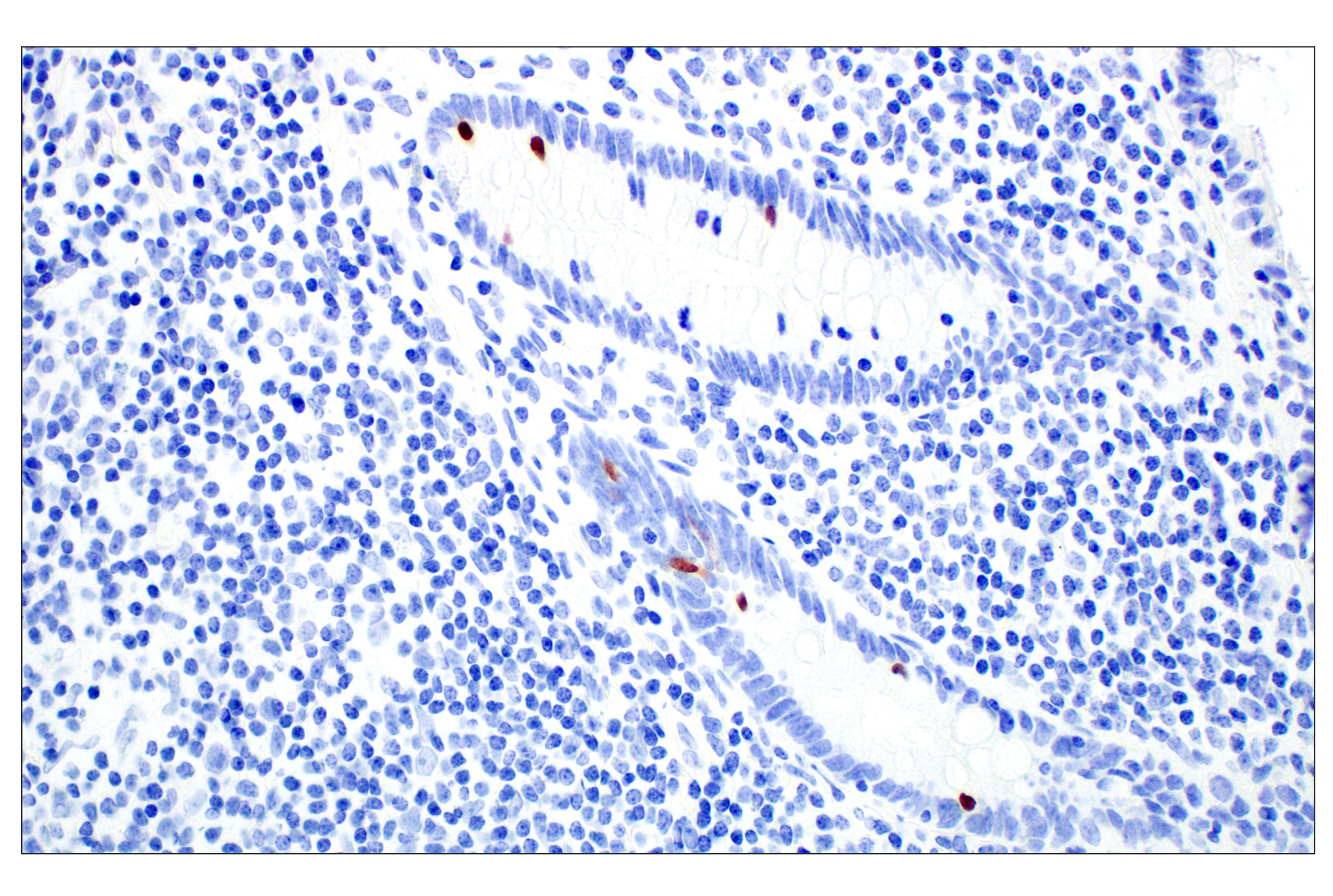 Immunohistochemistry Image 3: OCA-T1 (E4T1K) Rabbit mAb (BSA and Azide Free)